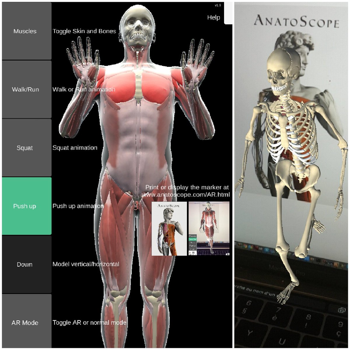 Anatoscope révolutionne la médecine personnalisée grâce à la simulation et l'impression 3D et permet à une nouvelle forme de production « artisanale » de haute technologie 100% française de rendre la fabrication de prothèses aussi compétitive qu’en Asie !