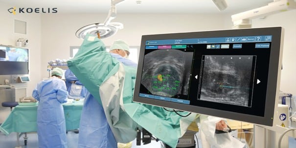 koelis traitements cancer prostate